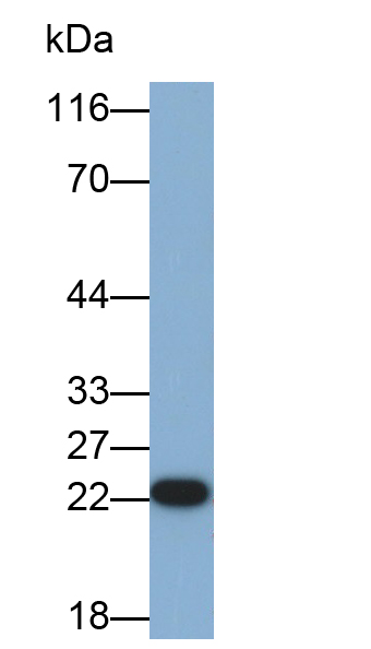 Polyclonal Antibody to Superoxide Dismutase 2, Mitochondrial (SOD2)