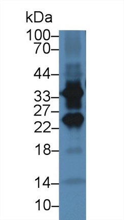 Polyclonal Antibody to Nucleoporin 37 (NUP37)