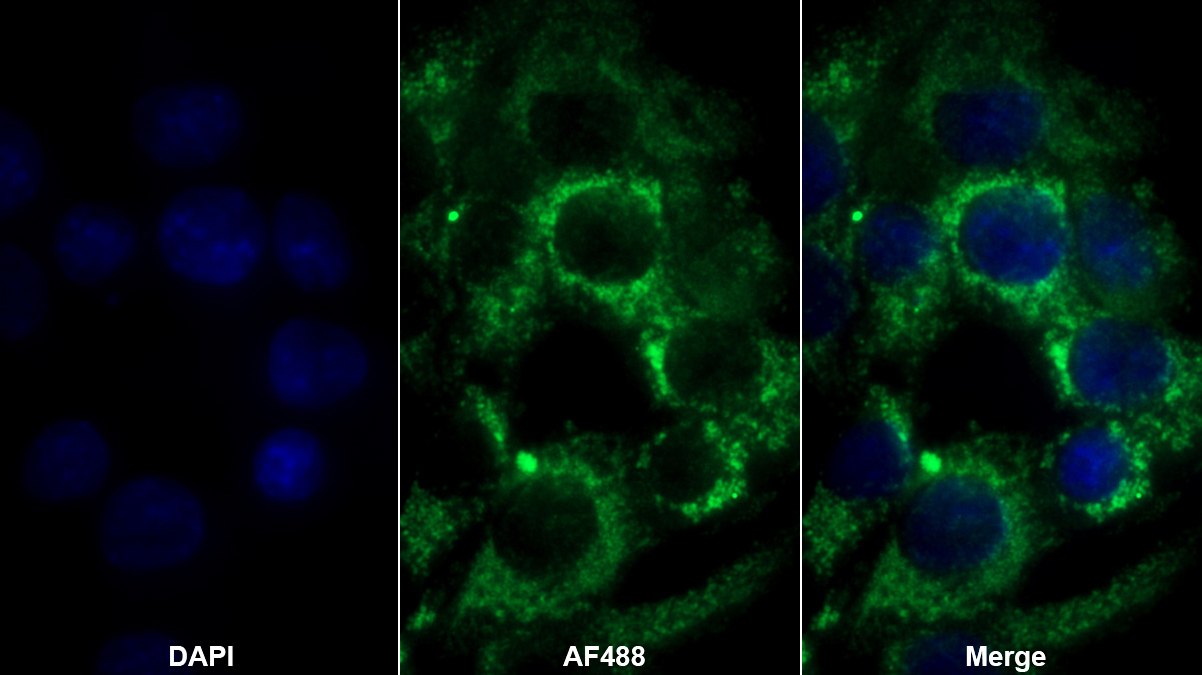 Polyclonal Antibody to Glutathione S Transferase Pi (GSTp)