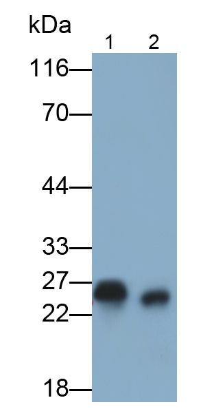 Polyclonal Antibody to Glutathione S Transferase Pi (GSTp)