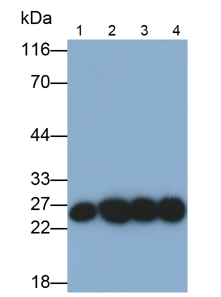 Polyclonal Antibody to Glutathione S Transferase Pi (GSTp)