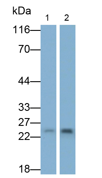 Polyclonal Antibody to Glutathione S Transferase Pi (GSTp)