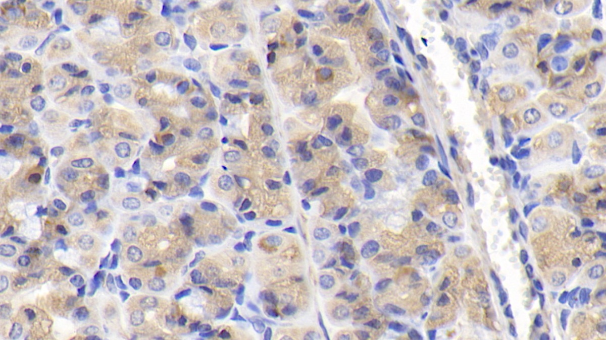 Polyclonal Antibody to Nucleoporin 85 (NUP85)