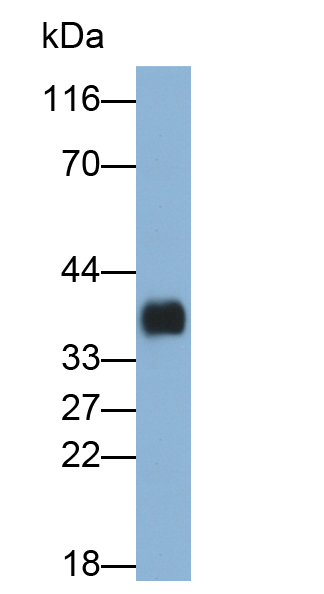 Polyclonal Antibody to Deoxyribonuclease I (DNASE1)