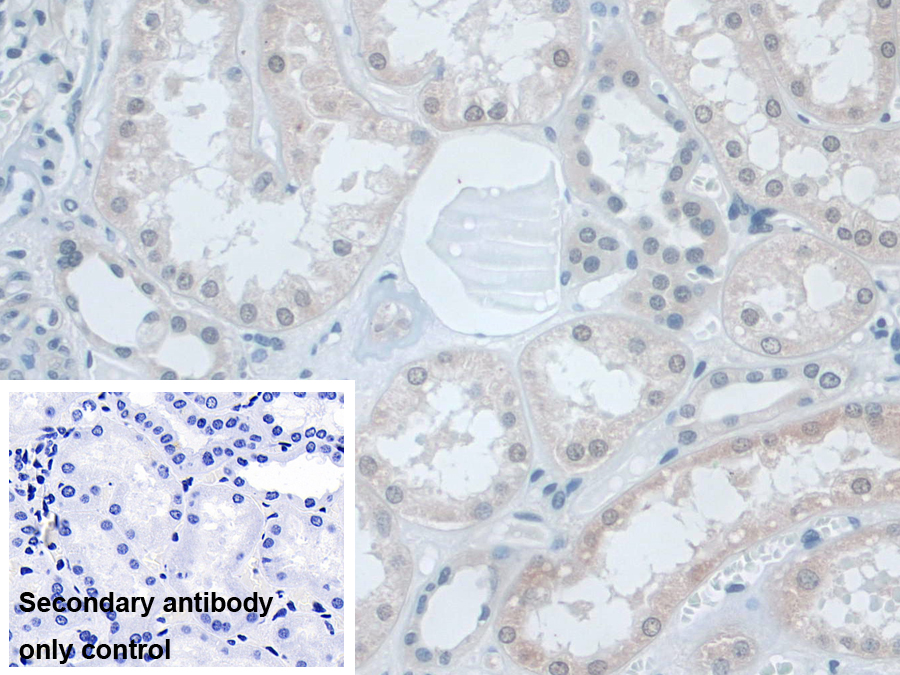 Polyclonal Antibody to Small Nuclear Ribonucleoprotein Polypeptide D1 (SNRPD1)