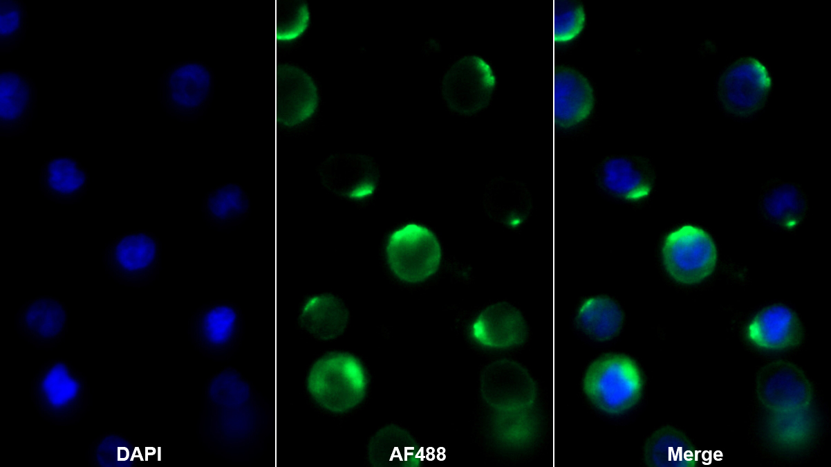 Polyclonal Antibody to Leukocyte Immunoglobulin Like Receptor Subfamily B, Member 2 (LILRB2)