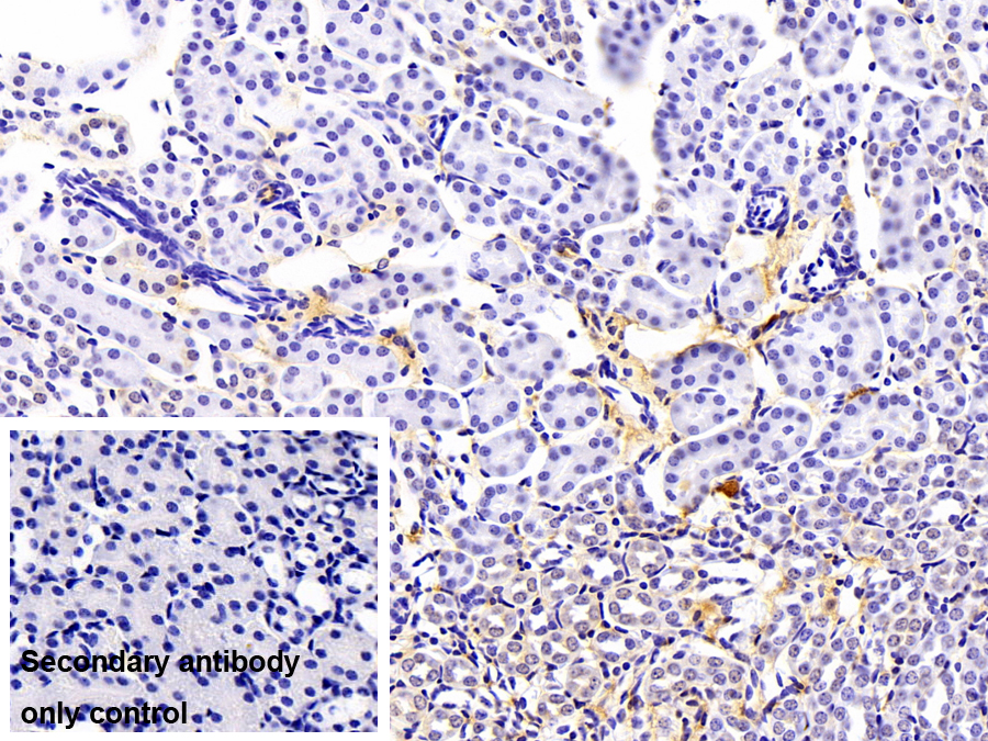 Polyclonal Antibody to Fibrinogen Alpha Chain (FGA)