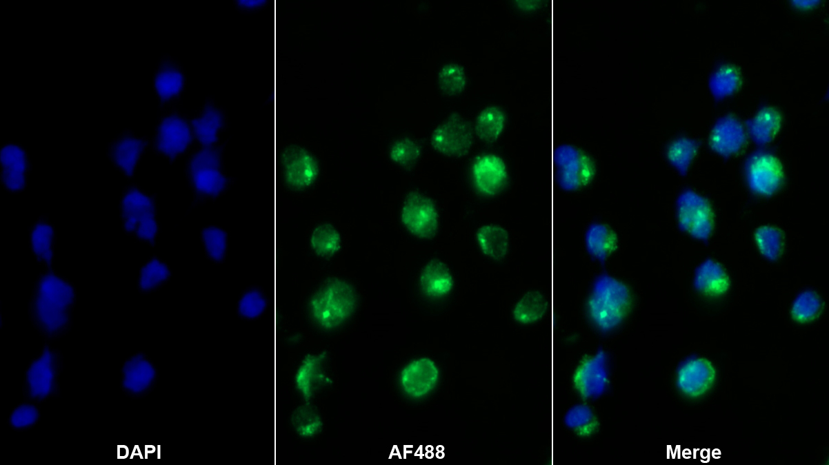 Polyclonal Antibody to Cluster Of Differentiation 1e (CD1e)