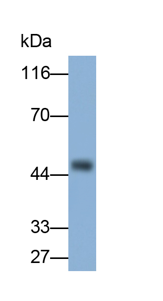 Polyclonal Antibody to Asialoglycoprotein Receptor 1 (ASGR1)