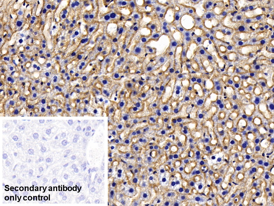 Polyclonal Antibody to Asialoglycoprotein Receptor 1 (ASGR1)