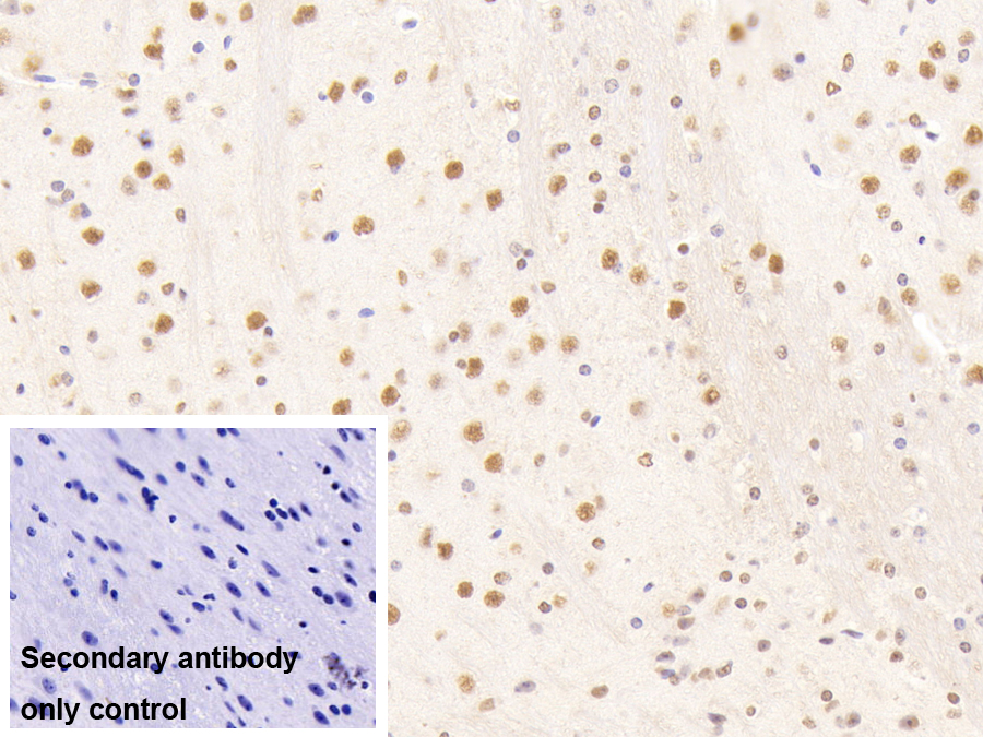 Polyclonal Antibody to Nucleoporin 88 (NUP88)