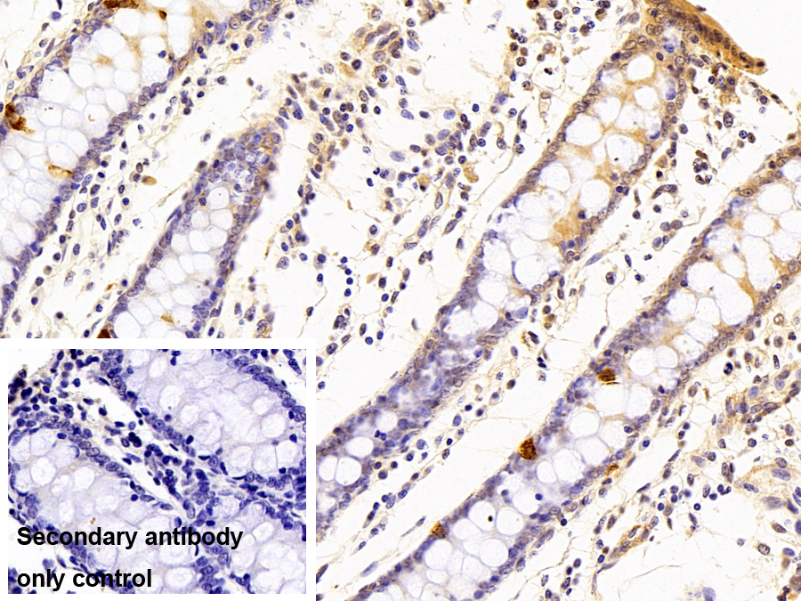 Polyclonal Antibody to Chromogranin A (CHGA)