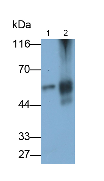 Polyclonal Antibody to Fibrinogen Beta Chain (FGB)