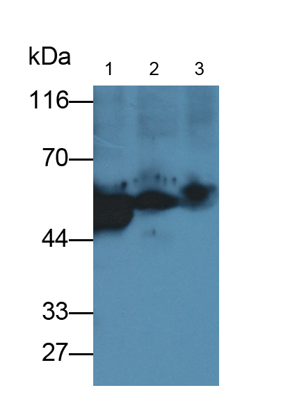 Polyclonal Antibody to Fibrinogen Beta Chain (FGB)