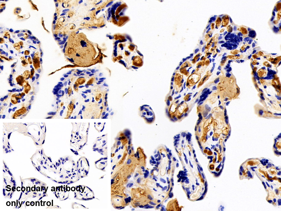 Polyclonal Antibody to Fibrinogen Beta Chain (FGB)