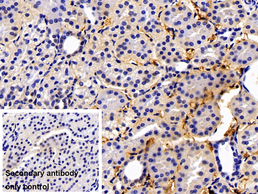 Polyclonal Antibody to Fibrinogen Beta Chain (FGB)