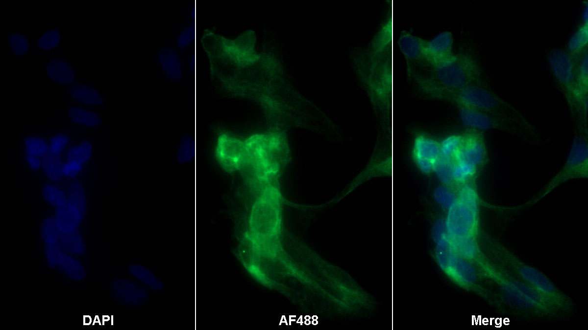 Polyclonal Antibody to Synuclein Alpha (SNCa)