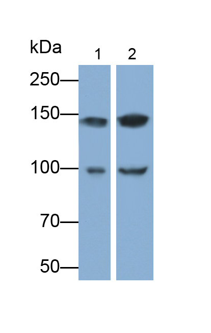 Polyclonal Antibody to Integrin Alpha 2 (ITGa2)