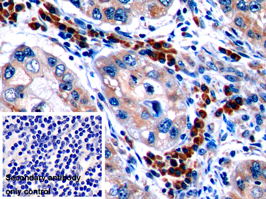 Polyclonal Antibody to Cytotoxic T-Lymphocyte Associated Antigen 4 (CTLA4)