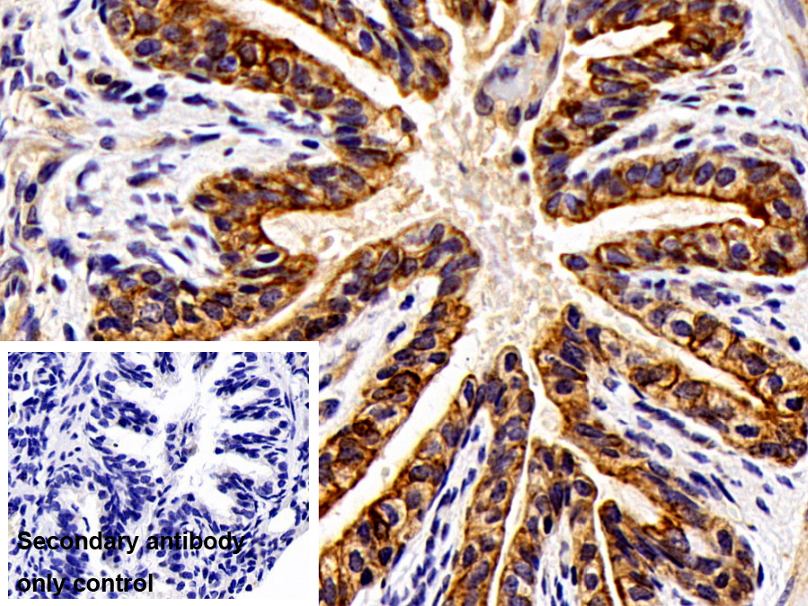 Polyclonal Antibody to Cytokeratin 18 (CK18)