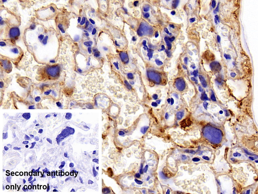 Polyclonal Antibody to Cytokeratin 18 (CK18)