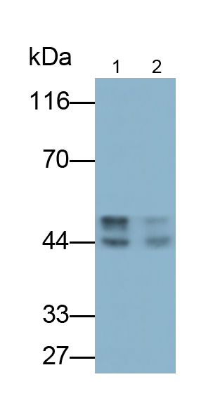 Polyclonal Antibody to Cytokeratin 18 (CK18)