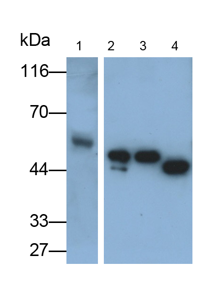 Polyclonal Antibody to Cytokeratin 18 (CK18)