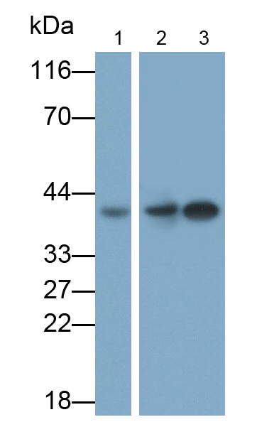 Polyclonal Antibody to Cytokeratin 19 (CK19)
