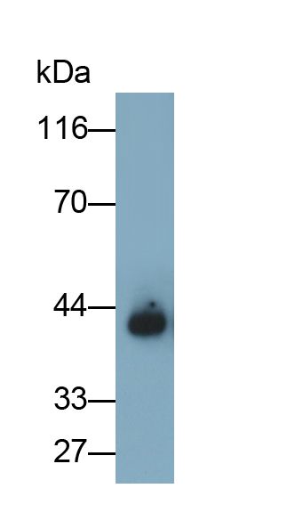 Polyclonal Antibody to Cytokeratin 19 (CK19)