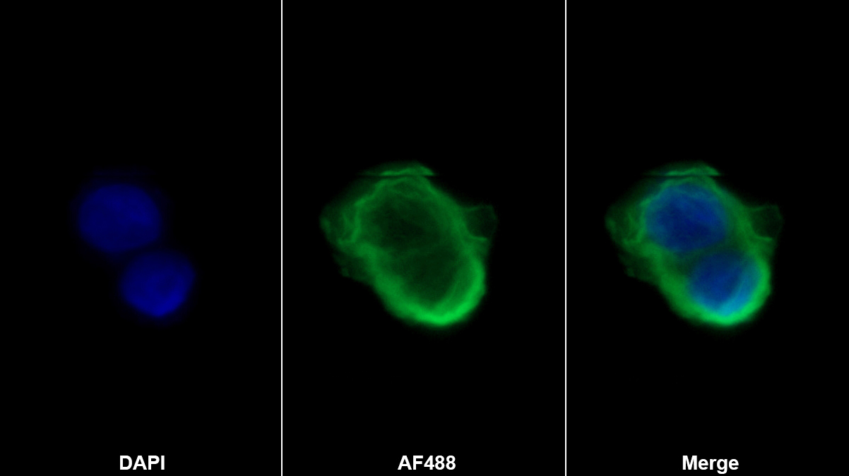 Polyclonal Antibody to Cytokeratin 19 (CK19)
