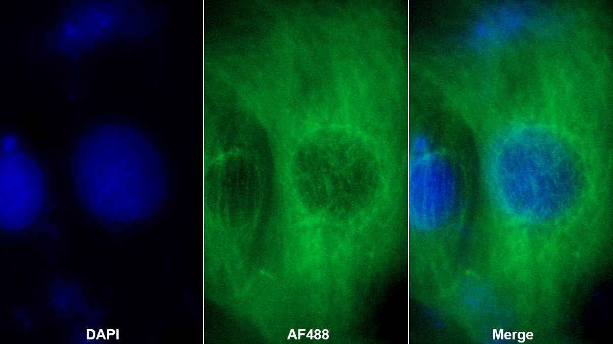 Polyclonal Antibody to Heart-type Fatty Acid Binding Protein (H-FABP)
