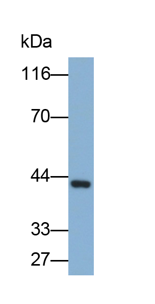 Polyclonal Antibody to Cytokeratin Fragment Antigen 21-1 (CYFRA21-1)