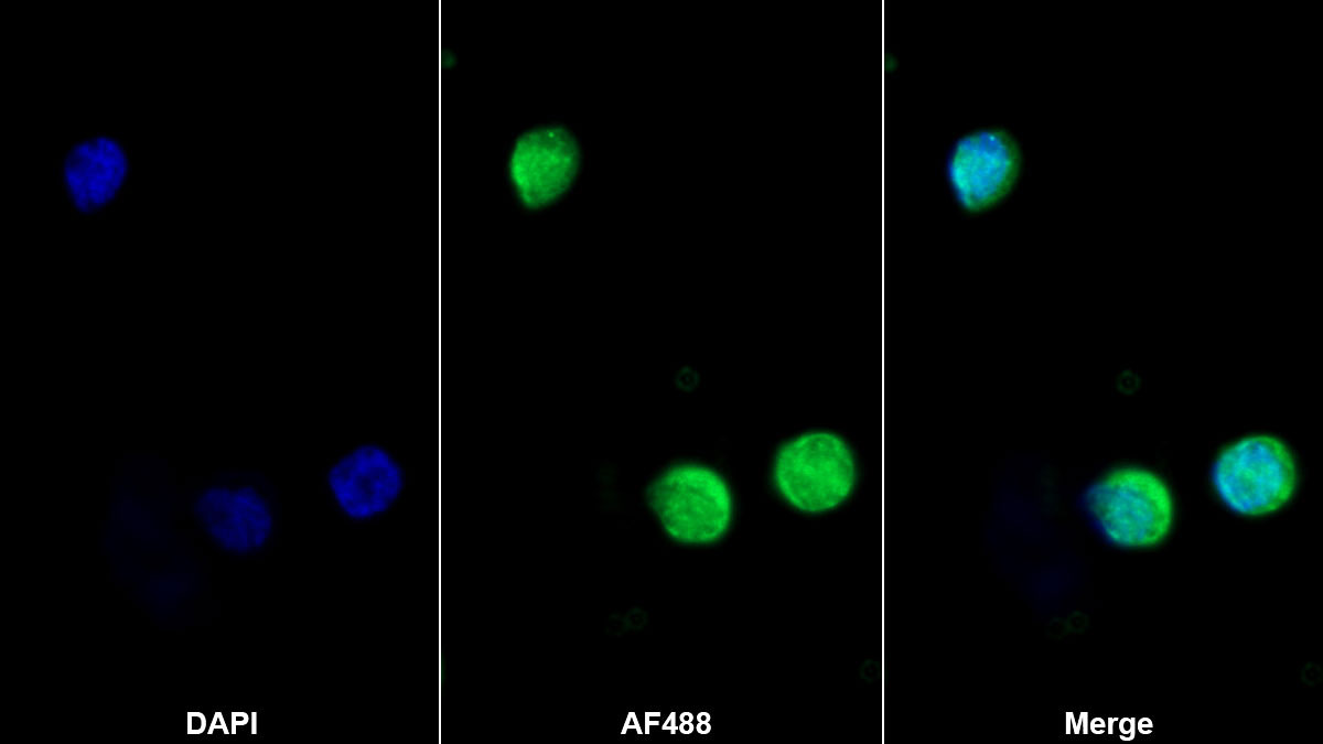 Polyclonal Antibody to Scavenger Receptor Class D Member 1 (SCARD1)