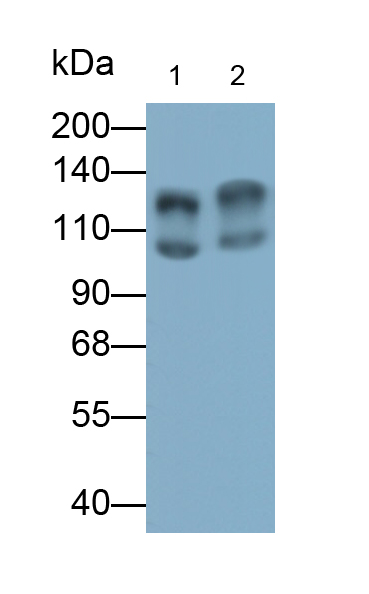 Polyclonal Antibody to Cluster Of Differentiation 72 (CD72)