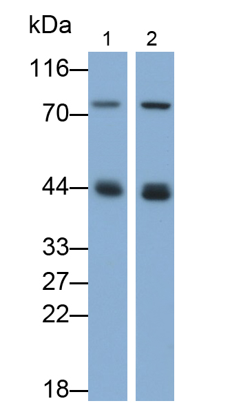 Polyclonal Antibody to Cathepsin D (CTSD)