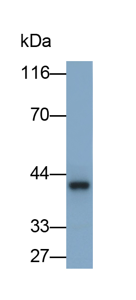 Polyclonal Antibody to Cathepsin D (CTSD)