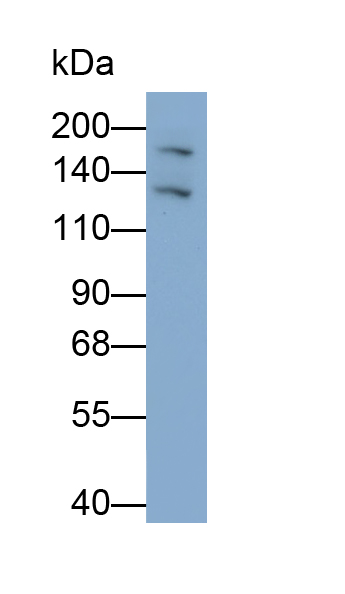 Polyclonal Antibody to Integrin Alpha 5 (ITGa5)