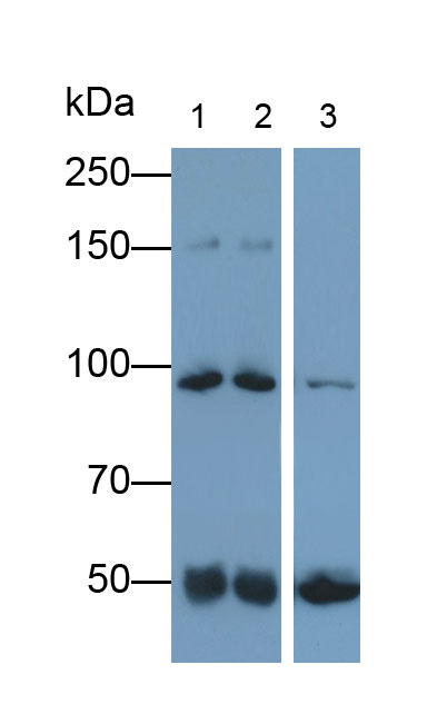 Polyclonal Antibody to Complement C4-B (C4B)