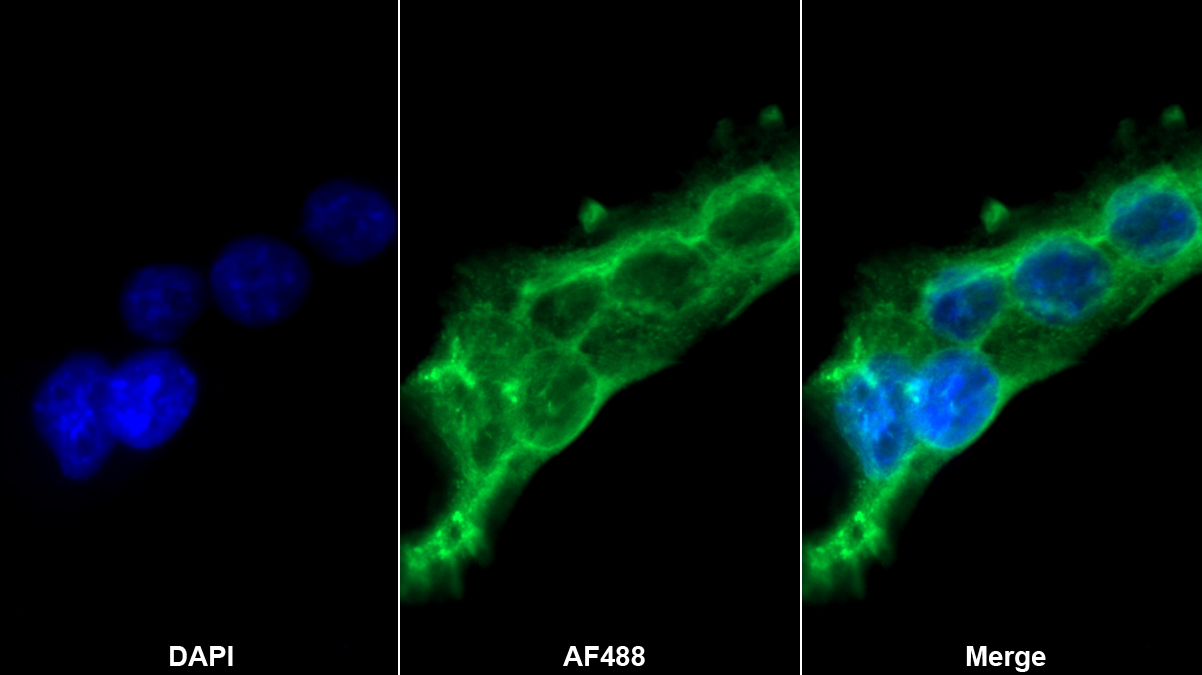 Polyclonal Antibody to Perforin 1 (PRF1)