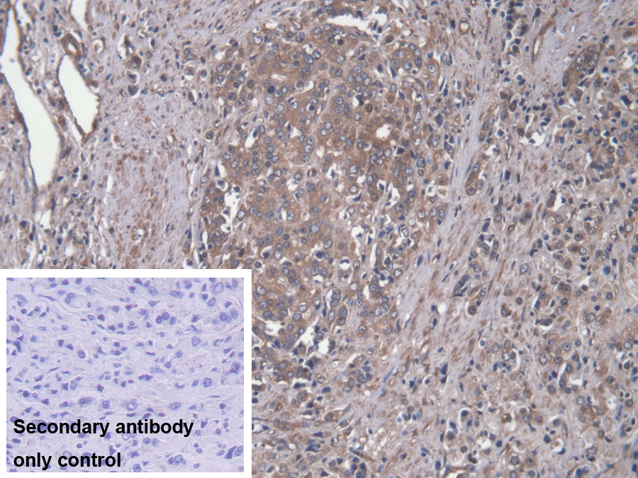 Polyclonal Antibody to Microtubule Associated Protein 4 (MAP4)