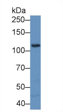 Polyclonal Antibody to Protein Tyrosine Kinase 2 Beta (PYK2)