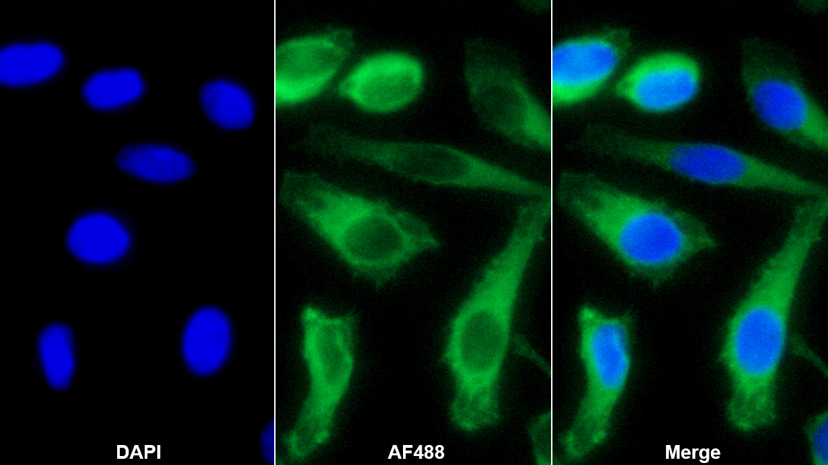 Polyclonal Antibody to Caldesmon (CALD)