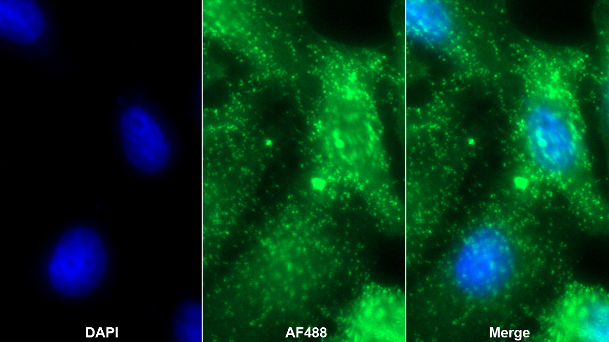 Polyclonal Antibody to Caldesmon (CALD)
