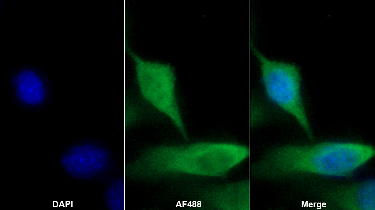 Polyclonal Antibody to Involucrin (INV)