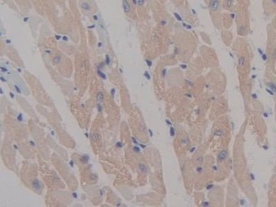 Polyclonal Antibody to Microtubule Associated Protein 6 (MAP6)