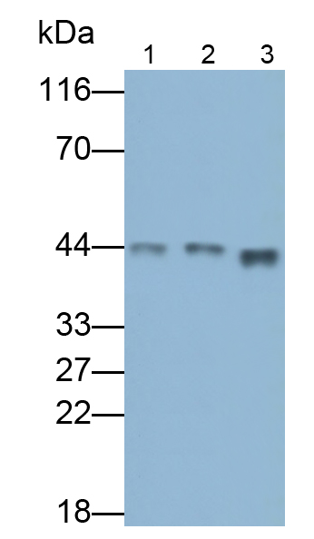 Polyclonal Antibody to Actin Gamma 2, Smooth Muscle (ACTg2)