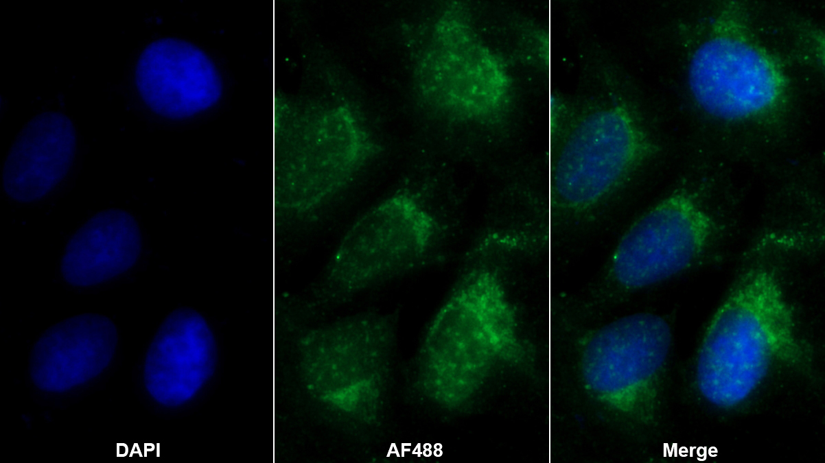 Polyclonal Antibody to Adipose Differentiation Related Protein (ADRP)