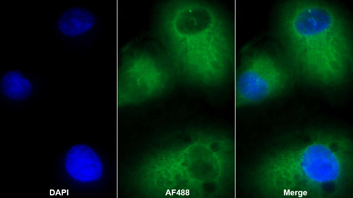 Polyclonal Antibody to Gamma-Glutamyltransferase 1 (gGT1)