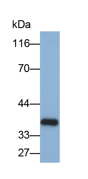 Polyclonal Antibody to Immune Receptor Expressed On Myeloid Cells 1 (IREM1)