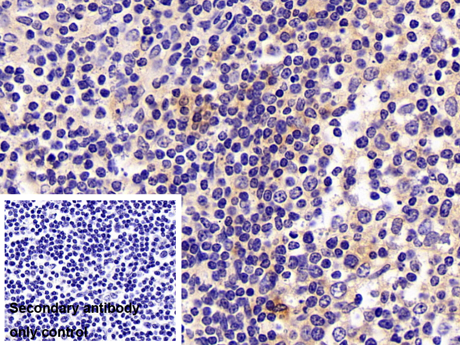 Polyclonal Antibody to Neutrophil gelatinase-associated lipocalin (NGAL)